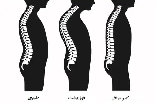 مزایا و معایب استفاده از قوزبند طبی